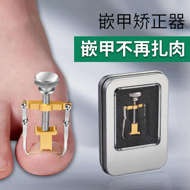 甲勾炎嵌甲矫正器