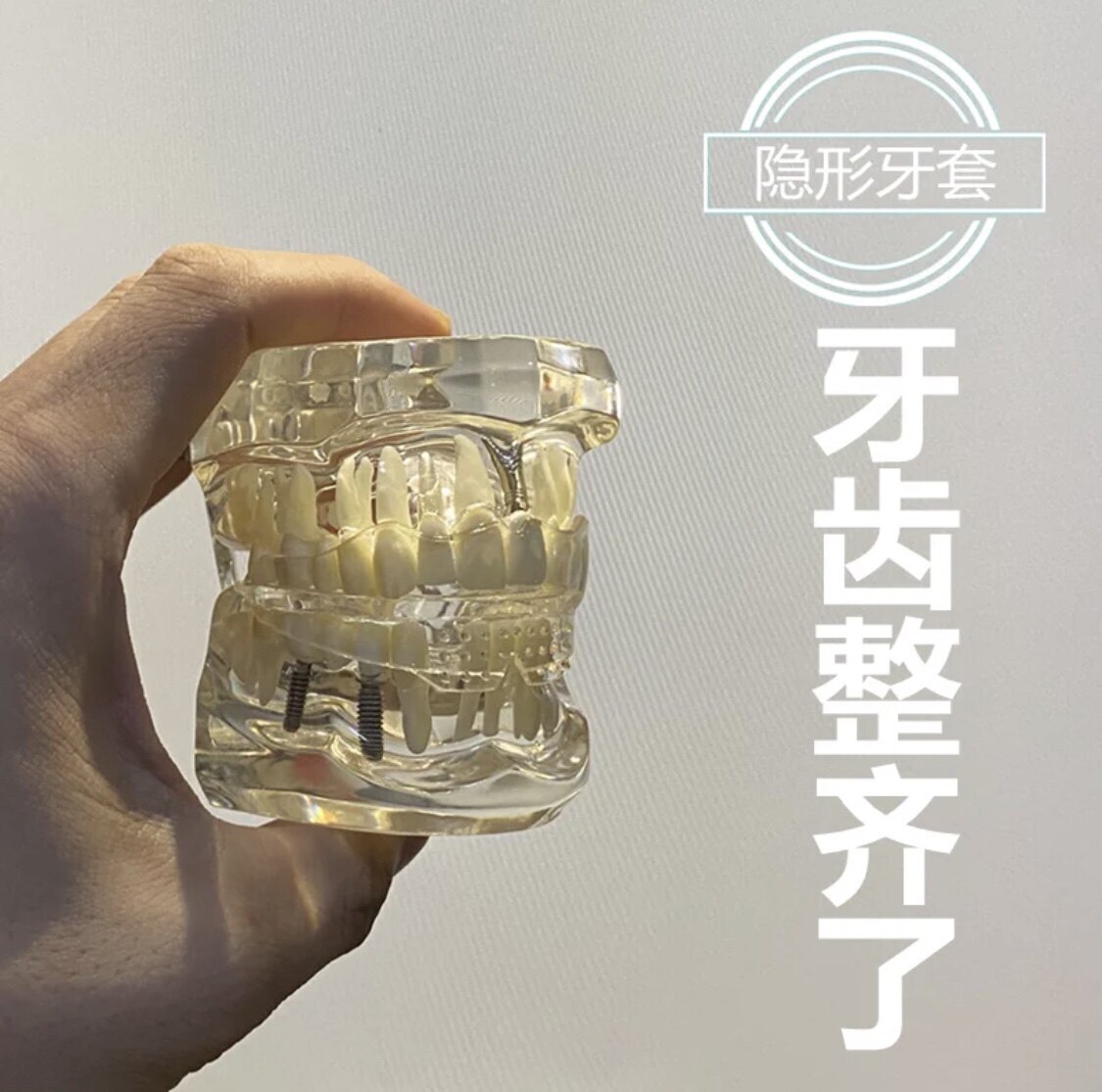 澳大利亚_儿童牙齿矫正器 地包天门牙龅牙学生成人通用隐形矫正牙套