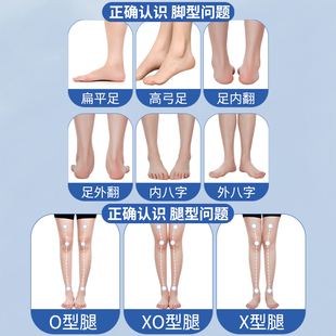 xo型腿矫正鞋垫小腿肌肉外翻膝矫正器o形腿x型改善腿型神器长直腿