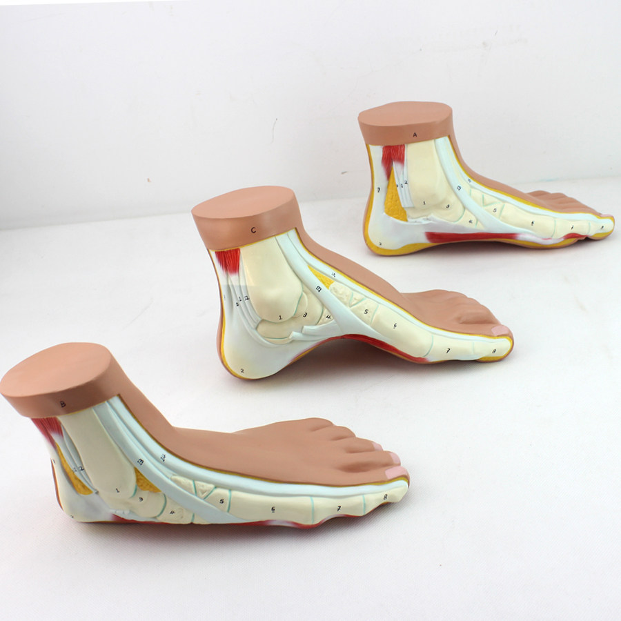 enovo正品医学正常足扁平足弓形足高弓足模型脚足弓模型 运动系统