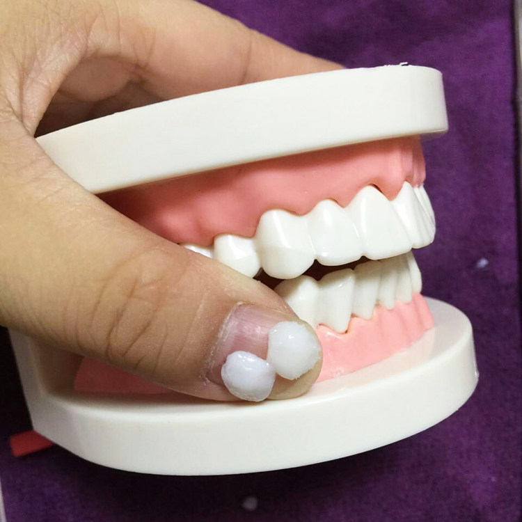牙齿美白练习模型冰瓷贴面纳米釉质树脂贴面练习模型11牙齿模型