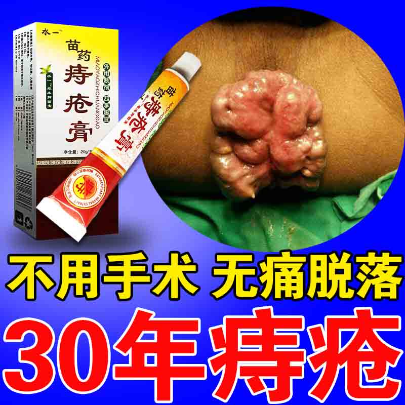 无花果叶子痔疮特效中药坐浴熏洗包偏方治疗肛周脓硬块肿疼消肉球