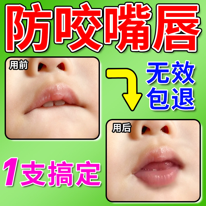 防咬下嘴唇纠正器日本戒咬嘴唇神器改善小孩子口呼吸矫正前庭盾贴