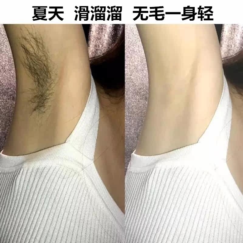 【第二件半价】轻松一脱~手臂退毛告别毛茸茸的生活~无毛一身轻