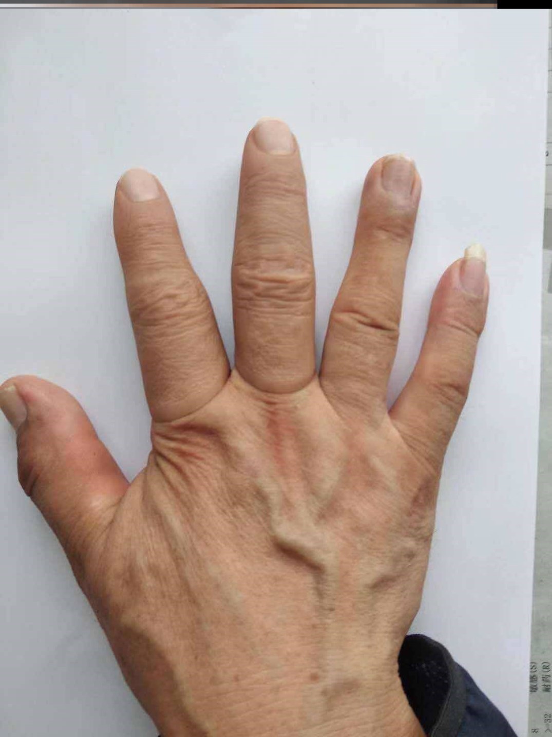 世界上手指最硬的人图片