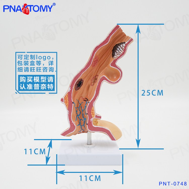 食管解剖模型食道消化系统科室医用教