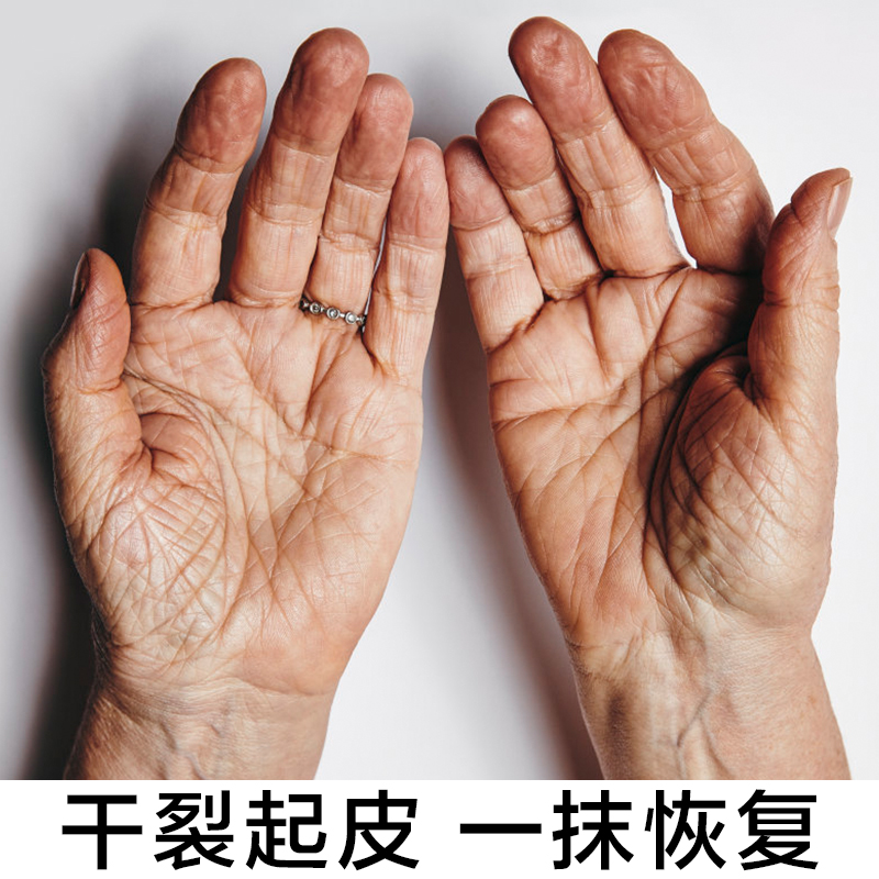 热销嫩手_【买二送一】手脚干裂一抹恢复去手部角质老茧死皮嫩手神器