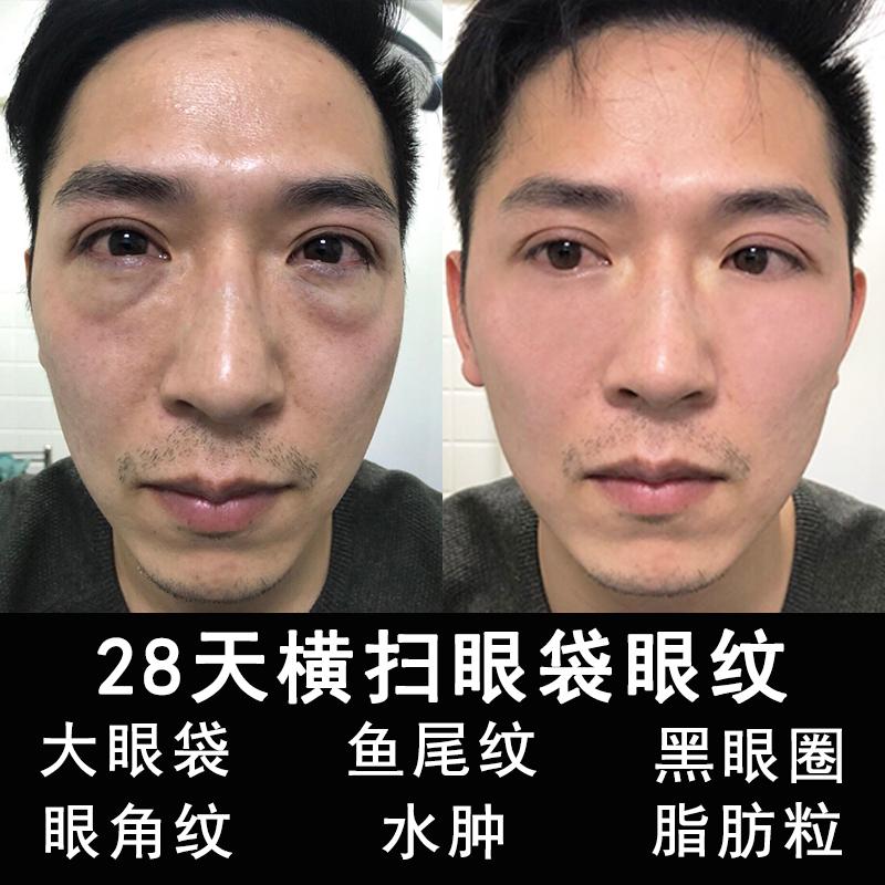 特价除黑眼圈淡化皱纹眼霜_去眼袋男神器男士眼霜祛细纹除皱纹消浮肿