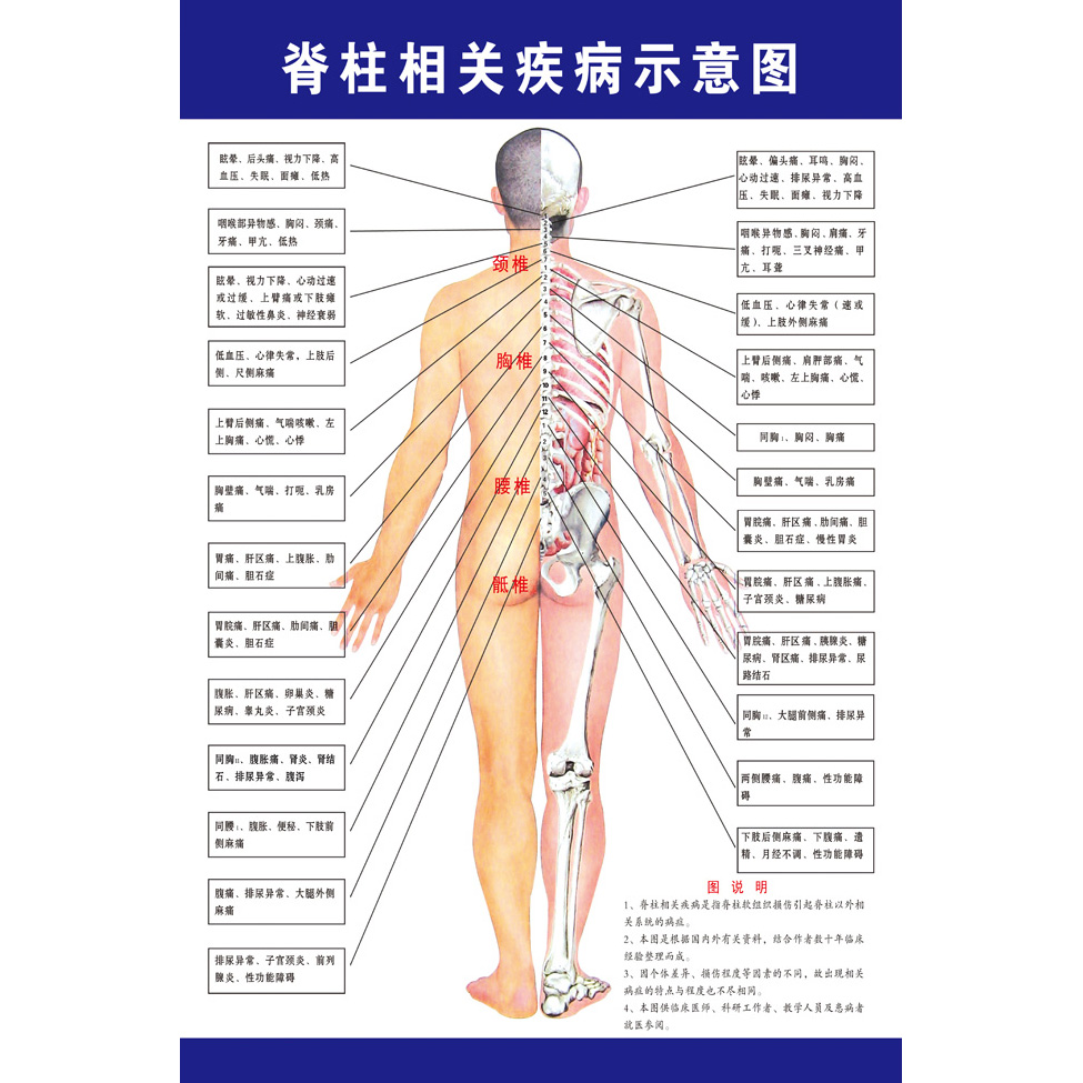 脊柱相关疾病示意图中医养生病理原因结构图挂图海报