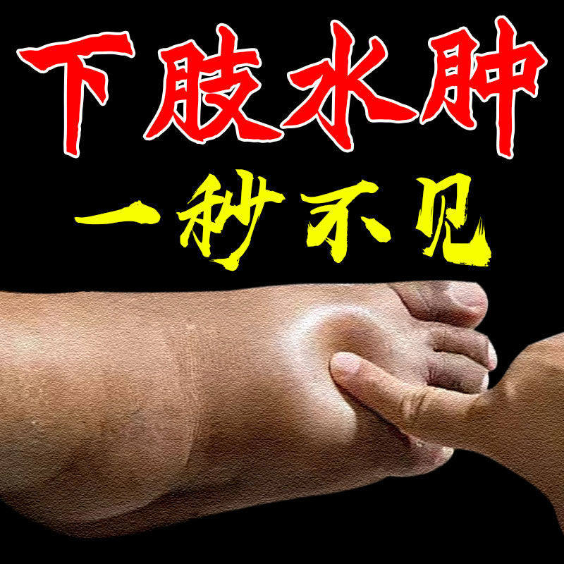 消水肿贴利尿去水肿脚肿消老人腿肿手肿四肢小腿全身肿胀浮肿神器