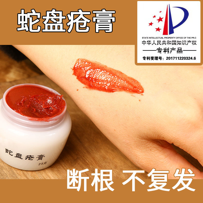 蛇盘疮后遗症 蛇胆疮蛇盘疮膏 神经刺痛蛇串疮缠腰蛇 带状疮泡疹