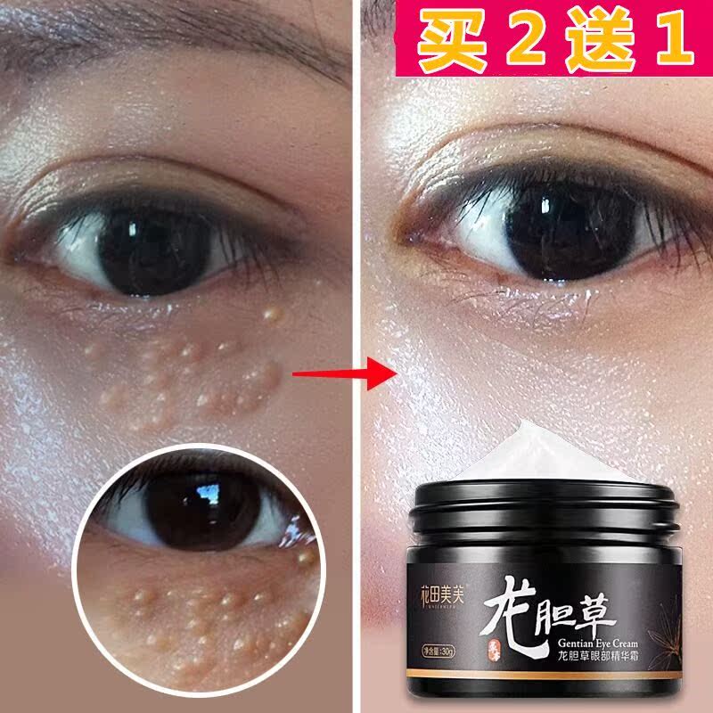 眼霜祛脂肪粒黑眼圈汗管原液神器特效專用膏臉部汗腺精華眼部去除在類目 洗護清潔劑/衛生巾/紙/香薰, 洗髮沐浴/個人清潔, 面部清潔/護理, 眼霜中 - 來自Buy2taobao.com提供專業的淘寶代購服務