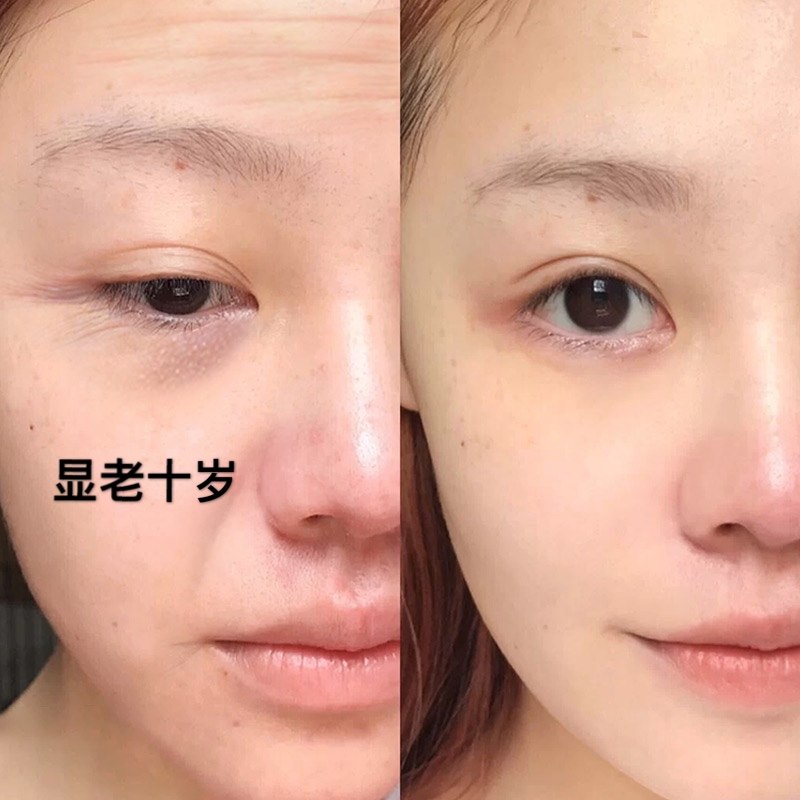 拜拜皱纹原液小红抗皱鱼油鳄鱼推荐单方精油