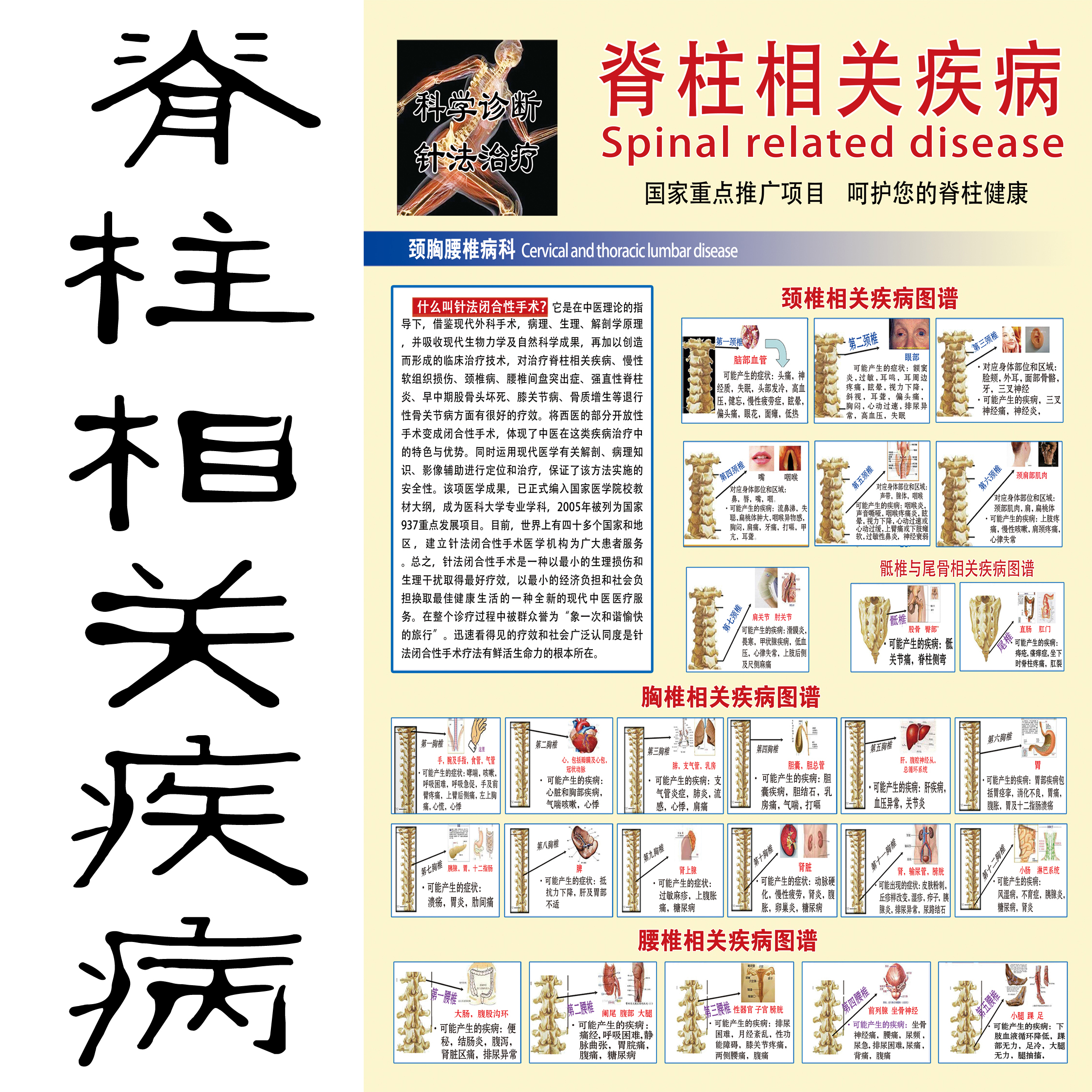 脊椎相关疾病示意图脊柱医学宣传挂图人体器官解剖图医院布置海报