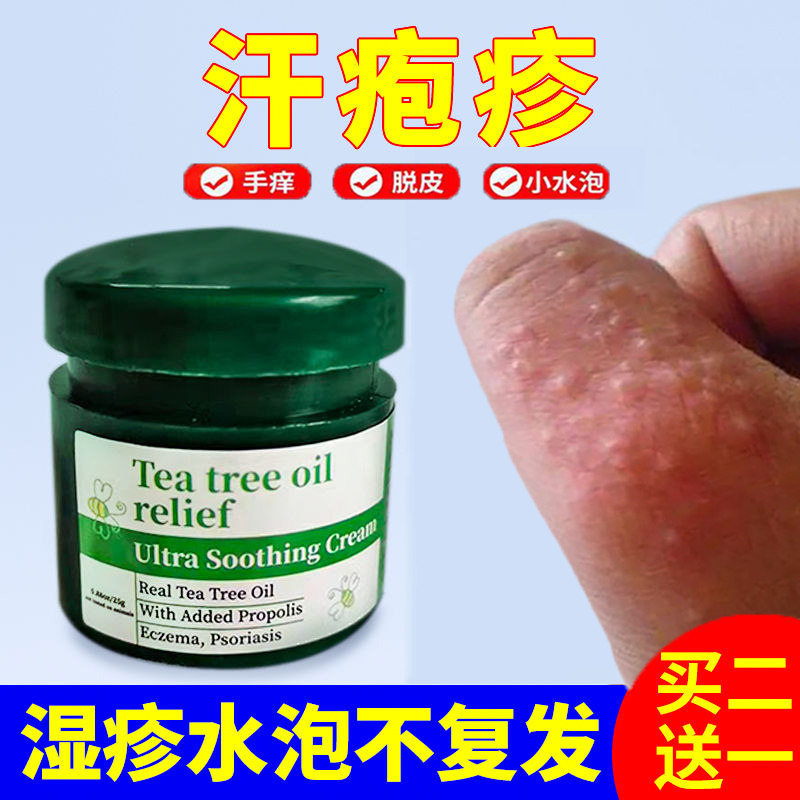 治疗汗疱疹汗孢疹汗状疱疹手脚足泡癣鹅掌风手上起小水泡感染药膏