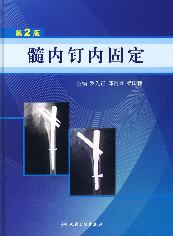 髓内钉内固定(第2版), 正版现货