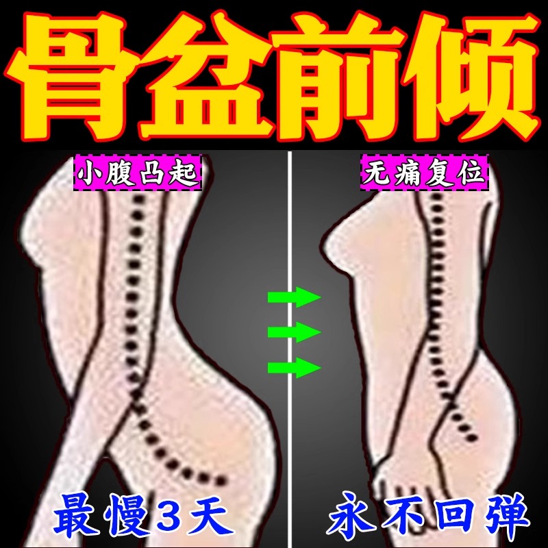 骨盆前倾矫正器盆骨小腹突出假胯宽专