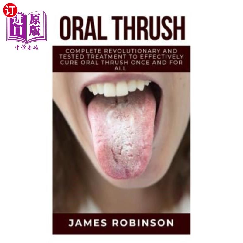 【中商海外直订】oral thrush: complete revolutionary and tested