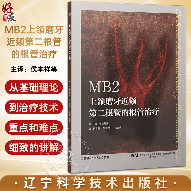 MB2上颌磨牙近颊第二根管的根管治