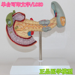 胰、脾、十二指肠病变模型 胰腺模型 脾脏模型 胰腺病理 病态脾脏