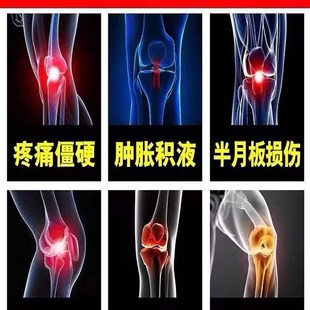 速发【当天不疼】膝盖疼痛专用药半月板损伤滑膜撕裂磨损关节疼痛