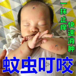 新品婴幼儿蚊虫叮咬快速止痒消肿药膏治疗成人小孩身上痒儿童止痒