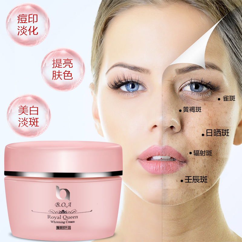 欧莱雅祛斑美白套装_祛斑美白小妙招,快速祛斑美白_欧莱雅美白祛斑系列