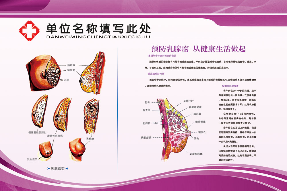 展板海报印制写真喷绘女性乳腺器官健康病变写真