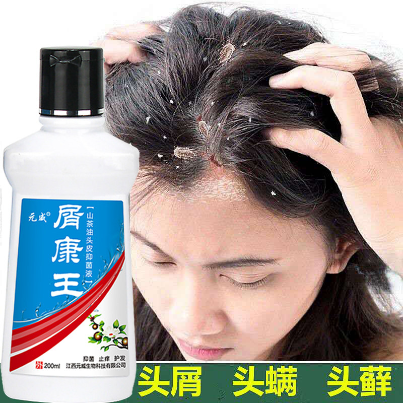 去屑_康王去屑止痒洗发水除螨控油洗发露脂溢性头皮屑药儿童剪发虫