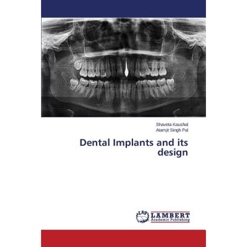 【4周达】Dental Implants and Its Design [9783659592294]