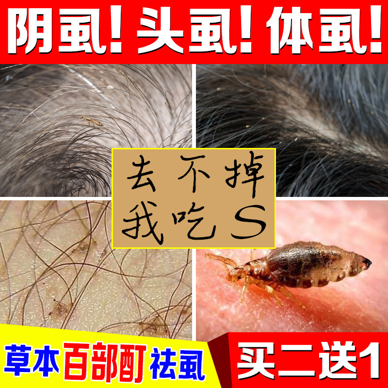 祛除虱子阴虱虱卵喷雾剂药康肤虱友皇3号男士杀虫剂卫生农药