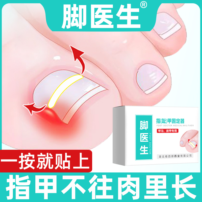 Foot doctor Paronychia Ingrown Toenails Dedicated Lara Toenail nail Orthotic device Patchin the Family/Personal Cleaning Tools , Personal care cleaning appliances , Nail clippers/Nail clippers , Nail/Manicure Set category - from Buy2taobao.com to provide professional Taobao agent buy service
