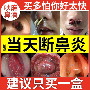 呋麻滴鼻滴液鼻塞通鼻神器过敏性鼻炎喷雾剂儿童鱼腥草滴鼻液G