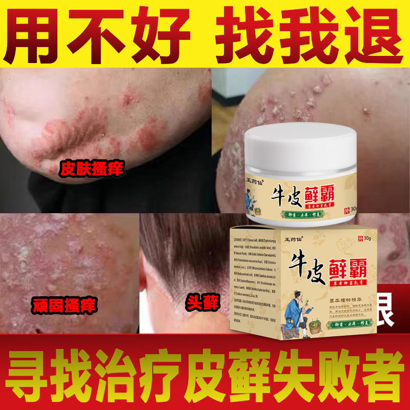 【直营】中国香港二天堂癣软膏手脚藓软膏香港脚痒进口青草膏抑菌