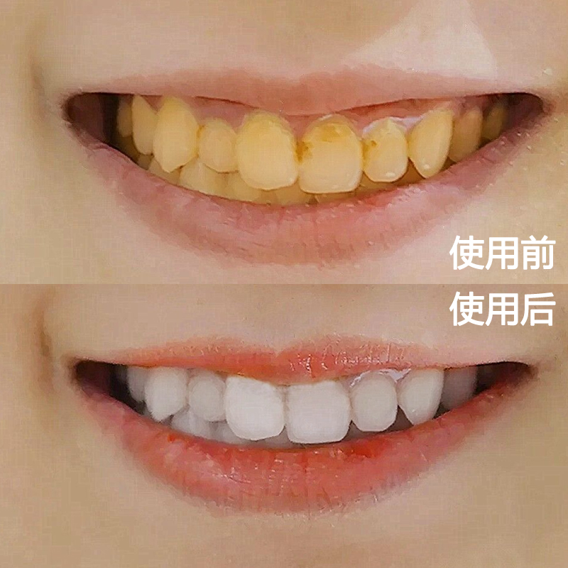 [Watson Explosive money Gargle Artifact oral cavity fresh Bacteriostasis stone men and women General 11in the Care cleaners/Sanitary napkins/Paper/Aromatherapy , Shampoo bath/Personal cleanliness , Oral Care , Toothpaste category - from Buy2taobao.com to provide professional Taobao agent buy service