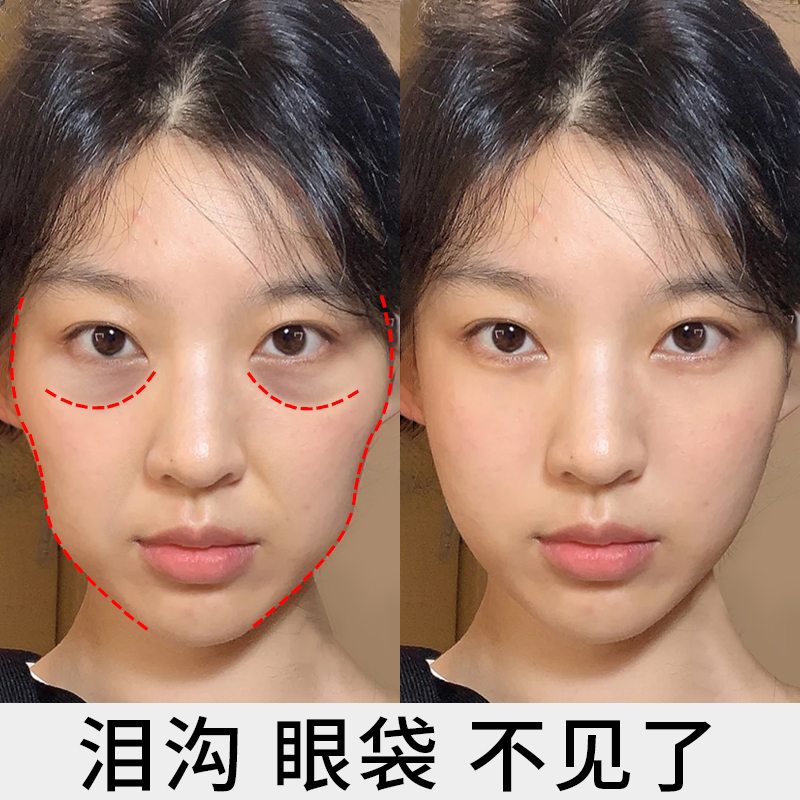 (今日9.5折)【李佳琪推荐 买2送1】去泪沟神器 不要凹陷脸丰盈精华液