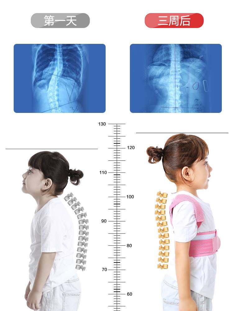 夏季儿童矫姿防驼背带矫正器小孩幼儿坐姿青少年学生背部纠正神