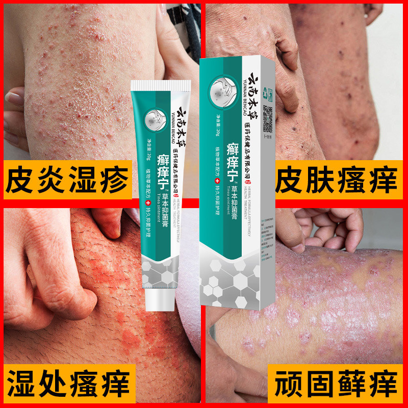 草本舒痒宁皮炎宁酊水正品藏方藓草苯海拉明乳膏仁肤堂氯霉素软膏