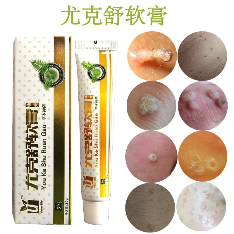 脖子尤克舒丝状疣跖疣扁平去除疣净肉刺去疣草本克疣霜疣克舒软膏