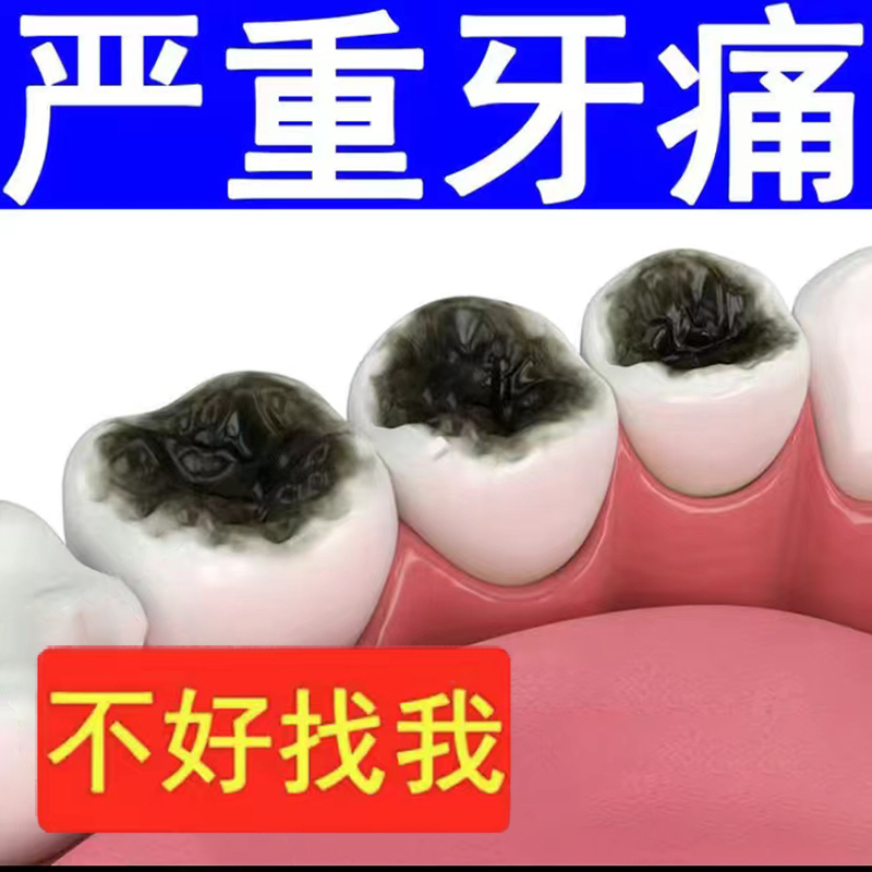 【护龈固齿】防蛀牙虫洞 牙齿黑窟窿