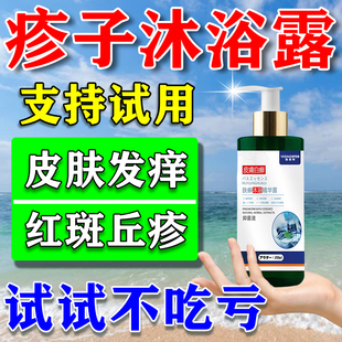 湿沐疹浴露止痒专儿用童顽固性皮癣去屁股湿根疹炉甘瘙石痒外用液