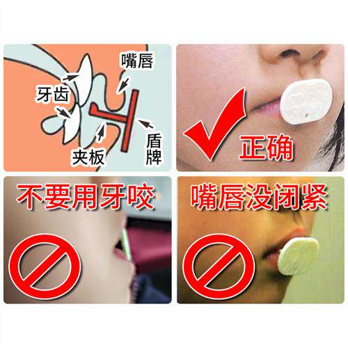 宝宝防咬下嘴唇神器咬嘴唇矫正器纠正小孩子口呼吸儿童前庭盾嘴凸