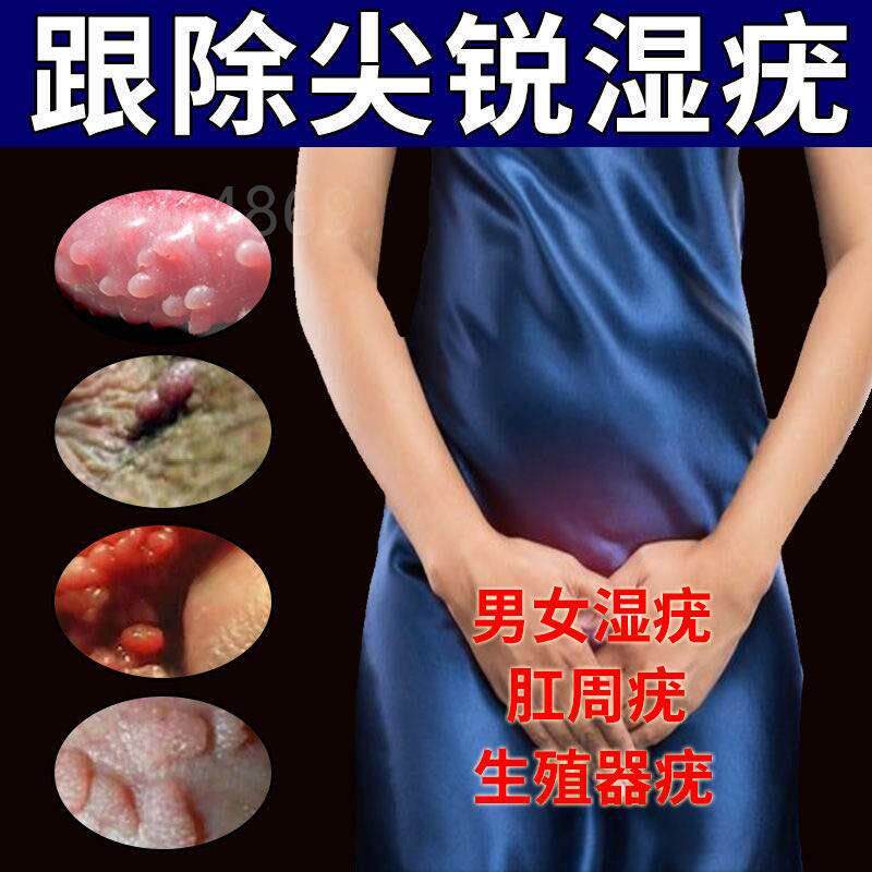 正品疣必清灵清除阴道肛门湿尤必治肉粒男女丝状疣立净防复发w