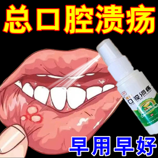 口腔溃疡喷剂口腔内壁嘴巴上火起泡烂舌头口疮黏膜溃疡修复液Z