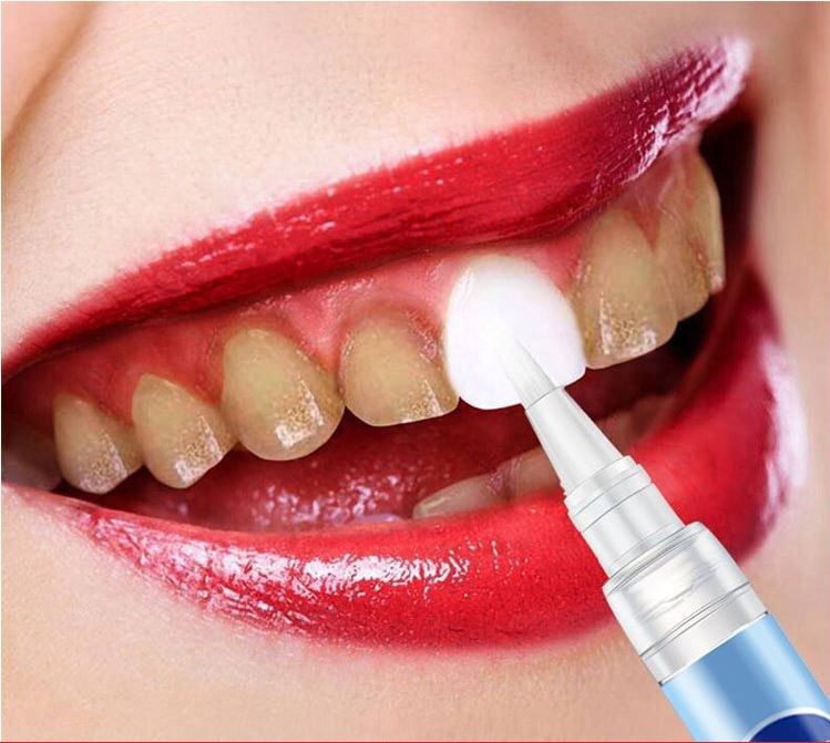 tt彩丽蔻美牙笔pen牙齿美白神器abisn牙齿cc笔洁牙提亮淡黄凝胶笔