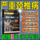 日本研发颈椎贴颈椎痛脖子疼痛僵硬头晕手麻膏贴富贵包原装理疗贴