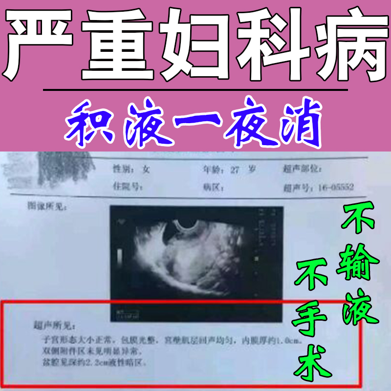 【当晚排出】治疗盆腔积液的药慢性盆