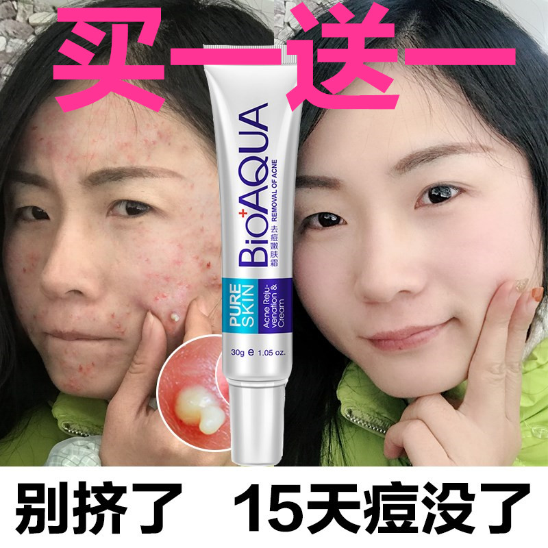 去痘印最有效的偏方_去 背后痘印 偏方_去下巴痘印偏方