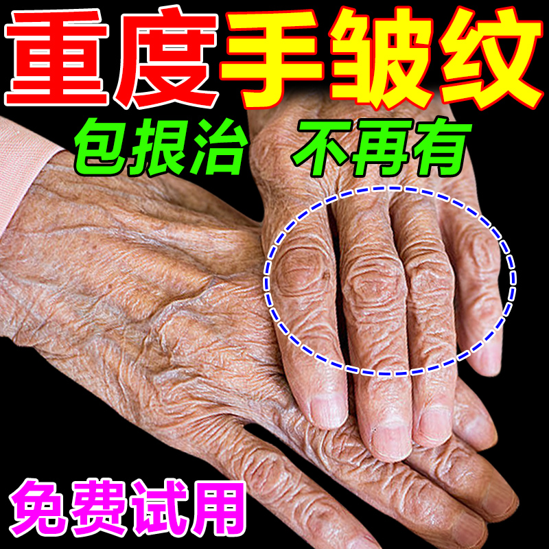 去手指关节皱纹祛除手纹护手霜去黑粗糙干燥修复嫩肤手部保养护理