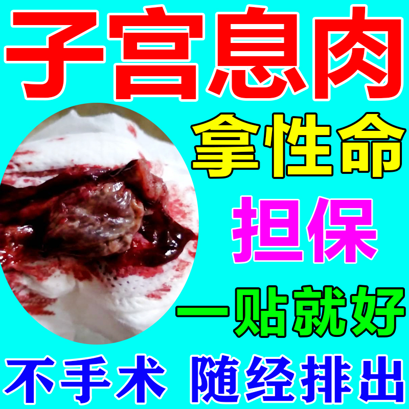 子宫内膜息肉药内膜太厚中药调理宫颈